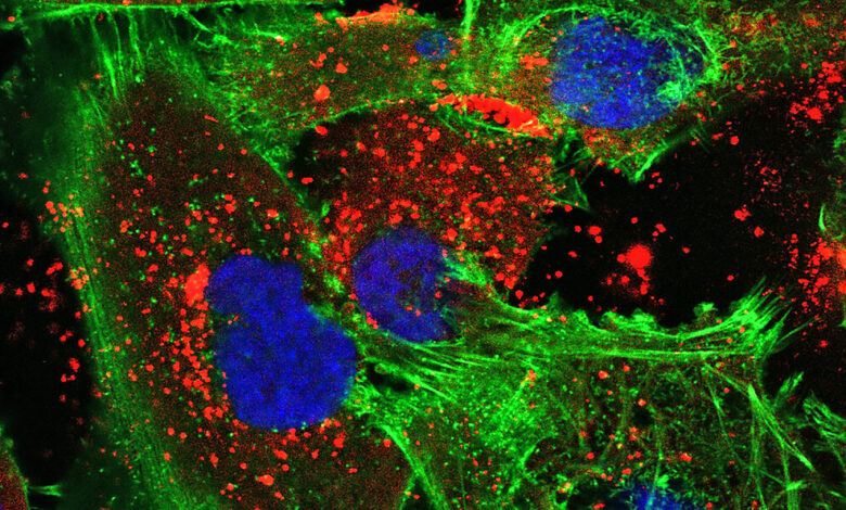 درمانی جدید مبتنی بر نانو ذرات برای مبارزه با نوعی تومور مغزی مهاجم