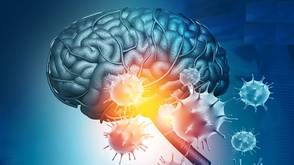 ویروس کرونا در طولانی مدت موجب اختلال مغزی می‌شود