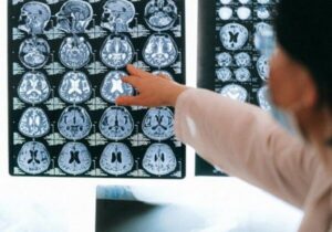 شناسایی علایم اولیه آلزایمر با بررسی گفتار افراد