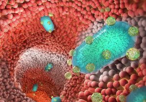 درمان التهاب روده به کمک فناوری نانو
