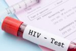 فناوری تولید کیت‌های تشخیص HIV توسعه می‌یابد