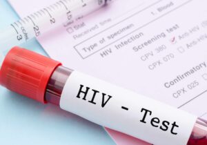 فناوری تولید کیت‌های تشخیص HIV توسعه می‌یابد