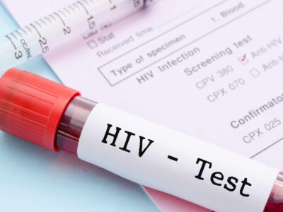 فناوری تولید کیت‌های تشخیص HIV توسعه می‌یابد