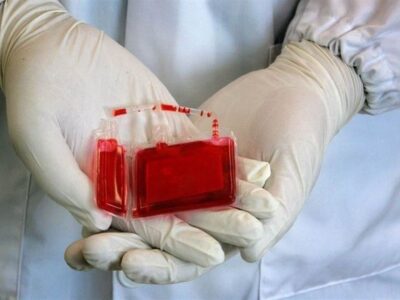 موفقیت ۸۰درصدی درمان بیماریهای خونی با نمونههای ذخیرهشده بندناف