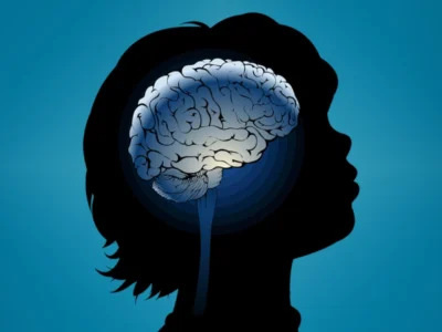 بهبود علائم و توانمندیهای بیماران فلج مغزی و اتیسم با سلولدرمانی