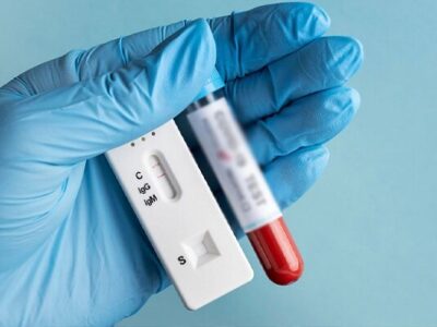 امید تازهای برای تشخیص زودهنگام سپسیس