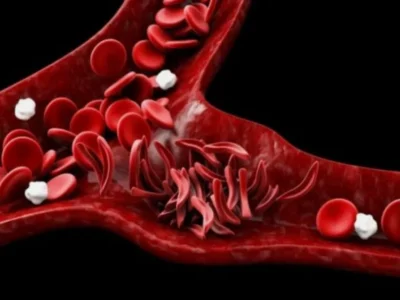 کارخانه خون‌سازی مغز استخوان انسان در آزمایشگاه ساخته شد