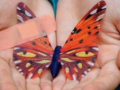 پانسمان ایرانی جایگزین نمونه سوئدی شد؛ در انتظار ۲۸ میلیارد تومان برای نجات بیماران پروانهای